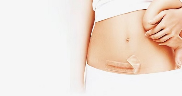 두꺼운 실리콘 젤 흉터 시트가 왜 그렇게 인기가 있습니까?